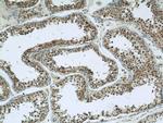 ARPC4 Antibody in Immunohistochemistry (Paraffin) (IHC (P))