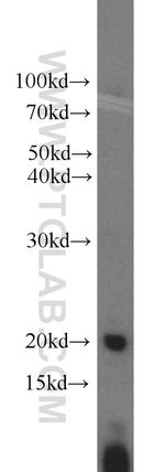 ARPC4 Antibody in Western Blot (WB)