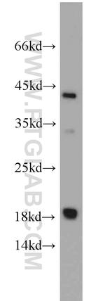 ARPC4 Antibody in Western Blot (WB)