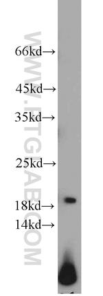 ARPC4 Antibody in Western Blot (WB)