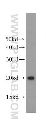 ARPC4 Antibody in Western Blot (WB)