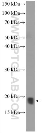 ARPC4 Antibody in Western Blot (WB)