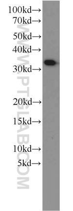 MEF2BNB Antibody in Western Blot (WB)