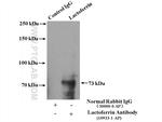 Lactoferrin Antibody in Immunoprecipitation (IP)