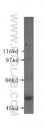 Lactoferrin Antibody in Western Blot (WB)