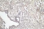 Cyclin D2 Antibody in Immunohistochemistry (Paraffin) (IHC (P))