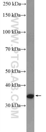 Cyclin D2 Antibody in Western Blot (WB)