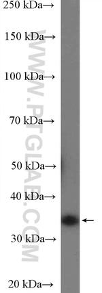 Cyclin D2 Antibody in Western Blot (WB)