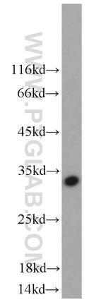 NKG2A Antibody in Western Blot (WB)