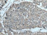 YWHAB Antibody in Immunohistochemistry (Paraffin) (IHC (P))