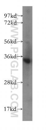 CRH/CRF Antibody in Western Blot (WB)