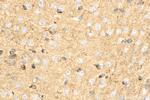 RTN4/NOGO Antibody in Immunohistochemistry (Paraffin) (IHC (P))