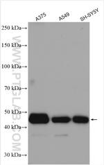 RTN4/NOGO Antibody in Western Blot (WB)