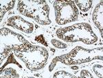 RTN4/NOGO Antibody in Immunohistochemistry (Paraffin) (IHC (P))