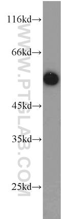 RTN4/NOGO Antibody in Western Blot (WB)