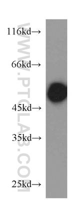 RTN4/NOGO Antibody in Western Blot (WB)