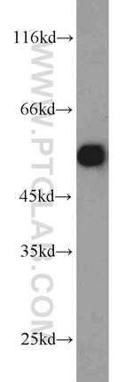 PDHX Antibody in Western Blot (WB)