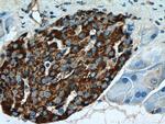 Secretogranin III Antibody in Immunohistochemistry (Paraffin) (IHC (P))