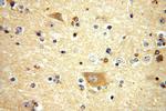 FIS1 Antibody in Immunohistochemistry (Paraffin) (IHC (P))