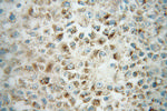 ACOX1 Antibody in Immunohistochemistry (Paraffin) (IHC (P))