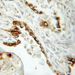 ACOX1 Antibody in Immunohistochemistry (Paraffin) (IHC (P))