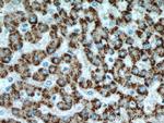 ACOX1 Antibody in Immunohistochemistry (Paraffin) (IHC (P))