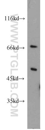 ACOX1 Antibody in Western Blot (WB)