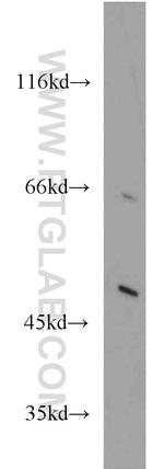 ACOX1 Antibody in Western Blot (WB)