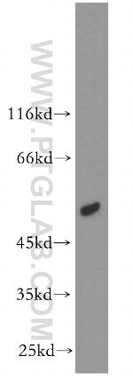 ACOX1 Antibody in Western Blot (WB)