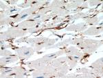 Cofilin Antibody in Immunohistochemistry (Paraffin) (IHC (P))