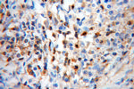 Cofilin Antibody in Immunohistochemistry (Paraffin) (IHC (P))