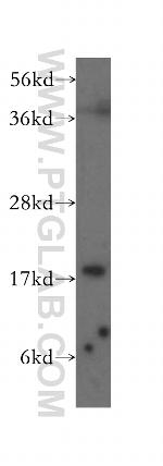 Cofilin Antibody in Western Blot (WB)