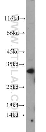 CDC34 Antibody in Western Blot (WB)