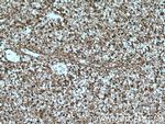 DCUN1D1 Antibody in Immunohistochemistry (Paraffin) (IHC (P))