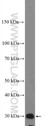 DCUN1D1 Antibody in Western Blot (WB)