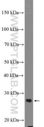 DCUN1D1 Antibody in Western Blot (WB)