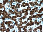 FH Antibody in Immunohistochemistry (Paraffin) (IHC (P))