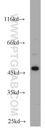 FH Antibody in Western Blot (WB)