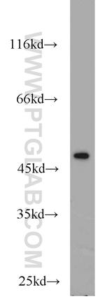 FH Antibody in Western Blot (WB)