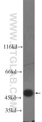 FH Antibody in Western Blot (WB)