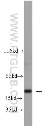 FH Antibody in Western Blot (WB)