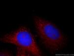 FH Antibody in Immunocytochemistry (ICC/IF)