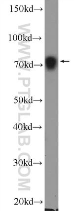 PABPC1/PABP Antibody in Western Blot (WB)