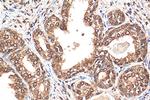 CTBP1 Antibody in Immunohistochemistry (Paraffin) (IHC (P))