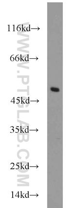 CTBP1 Antibody in Western Blot (WB)