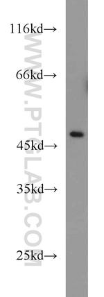 CTBP1 Antibody in Western Blot (WB)