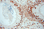 CTBP1 Antibody in Immunohistochemistry (Paraffin) (IHC (P))