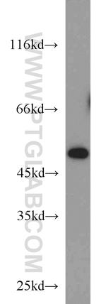 CTBP1 Antibody in Western Blot (WB)