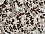 Nurr1/NR4A2 Antibody in Immunohistochemistry (Paraffin) (IHC (P))