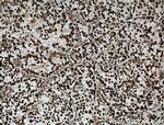 Nurr1/NR4A2 Antibody in Immunohistochemistry (Paraffin) (IHC (P))